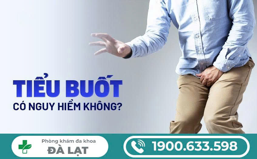 Hình ảnh minh họa